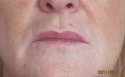 Beryl maquillaje semipermanente labios antes (Copy)